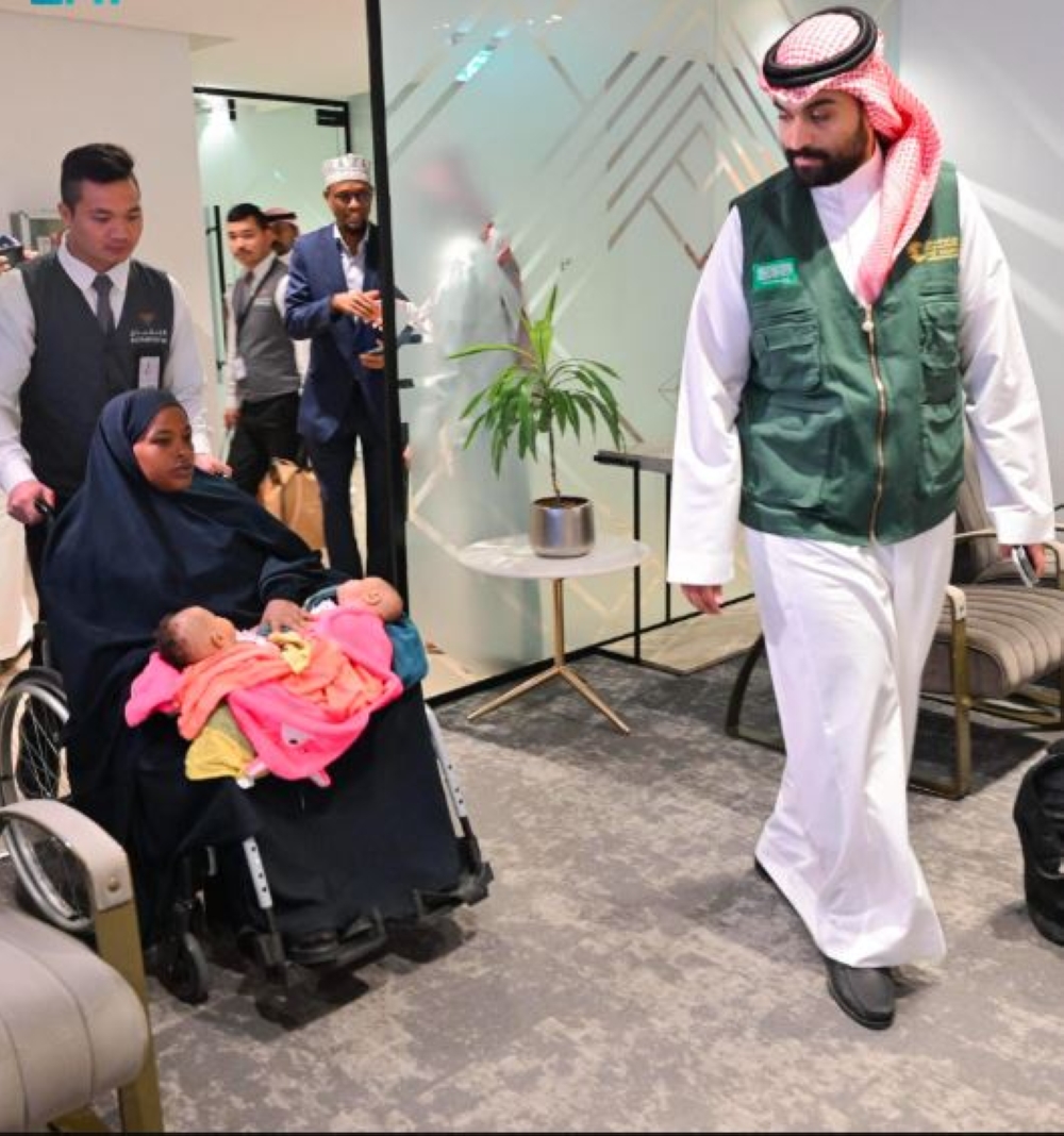 صور| التوأم الملتصق الصومالي “رحمة ورملا” يصلان الرياض لدراسة حالتهما